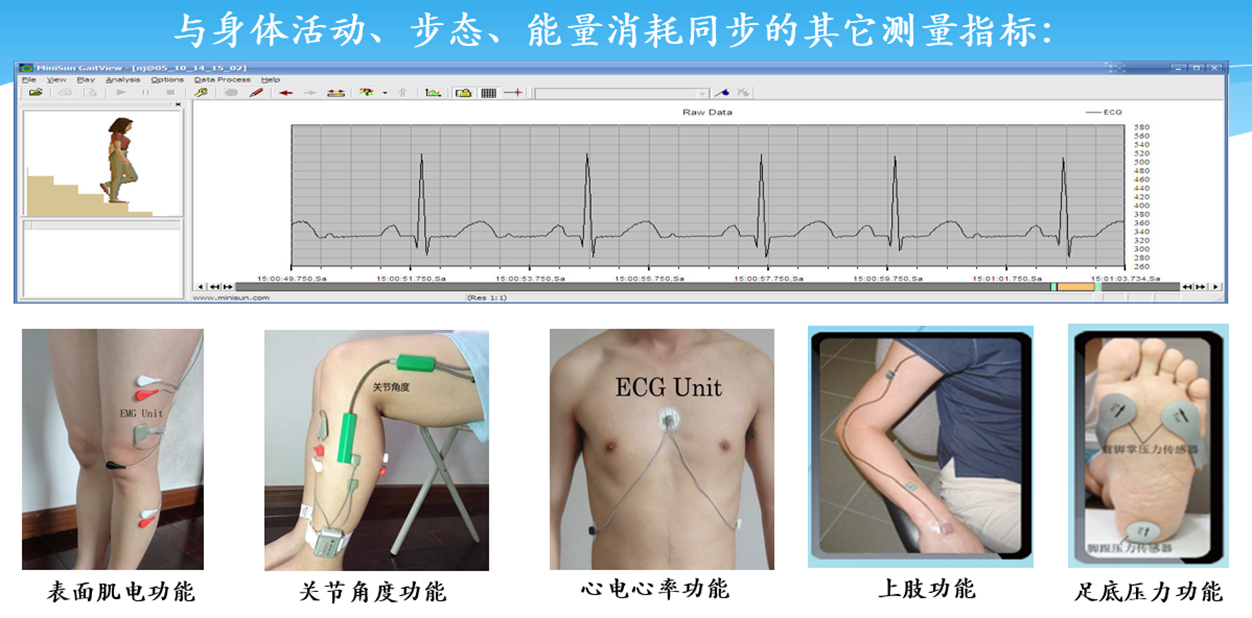 智能化步态分析仪(图4)